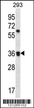 OR52E2 Antibody (C-term)