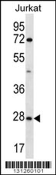 OR6T1 Antibody (C-term)