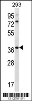 OR6X1 Antibody (C-term)