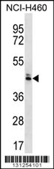 OR52N5 Antibody (C-term)
