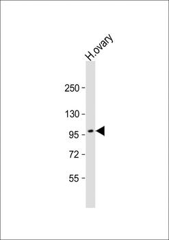 ESPNL Antibody (C-term)