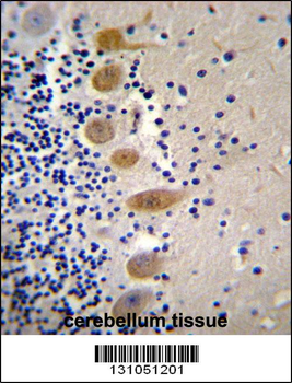 MST1 Antibody (C-term)