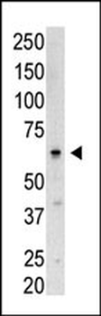 SENP3 Antibody (N-term)