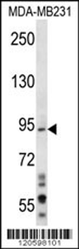 MAD1L1 Antibody (N-term)