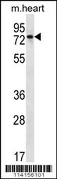 PARP2 Antibody (C-term)