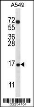 COX7A2L Antibody (Center)