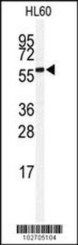 SENP2 Antibody (C-term)