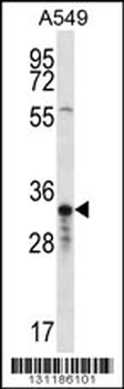 OR4F5 Antibody (N-term)