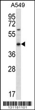 OR51S1 Antibody (C-term)