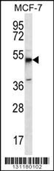 MBOAT4 Antibody (Center)