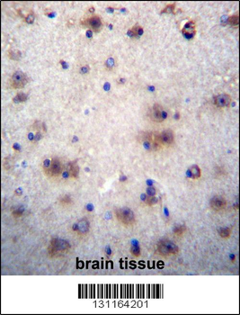 EVPLL Antibody (Center)