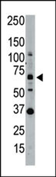 SENP1 Antibody (N-term)