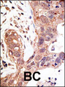 SENP1 Antibody (N-term)