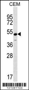 KCNJ8 Antibody (N-term)