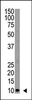Ubiquitin Antibody (N-term)