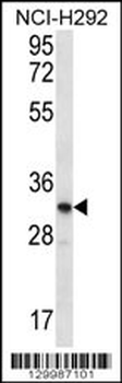 OR51L1 Antibody (N-term)