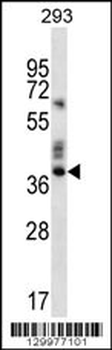 OR9K2 Antibody (C-term)