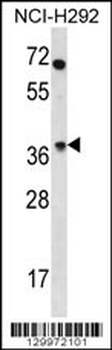 OR4N2 Antibody (N-term)