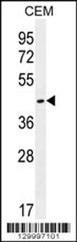OR8H2/OR8H3 Antibody (C-term)