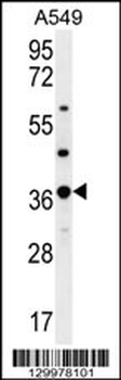 OR4M1 Antibody (C-term)