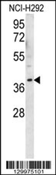 OR2AK2 Antibody (C-term)