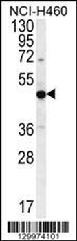 PRAMEF8 Antibody (C-term)