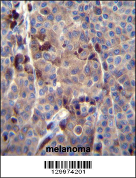 PRAMEF8 Antibody (C-term)