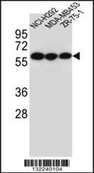 CHRNA10 Antibody (Center)