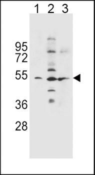 SLC36A1 Antibody (N-term)