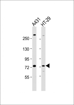 PAK6 Antibody (Center)