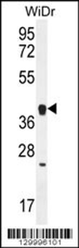 OR2T8 Antibody (C-term)