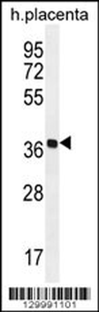OR5AS1 Antibody (C-term)