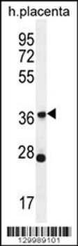 OR4L1 Antibody (C-term)