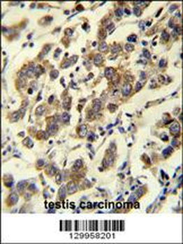 MBD3L3 Antibody (C-term)