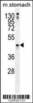 TRIM69 Antibody (N-term)