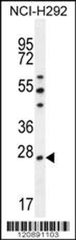 PRDX4 Antibody (Center)