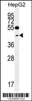 TXNL2 Antibody (N-term)