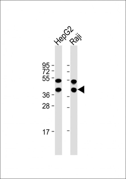 TXNL2 Antibody (N-term)