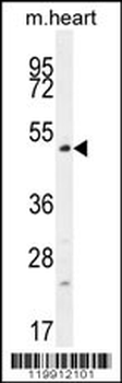 TSPYL4 Antibody (C-term)