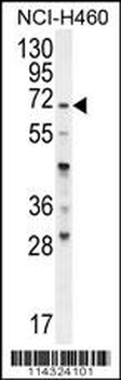 FUT4 Antibody (C-term)