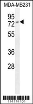 Tiparp Antibody (C-term)