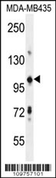 TRIM33 Antibody (C-term)
