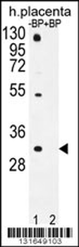 OR1D5 Antibody (C-term)