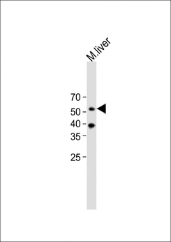 ARRB1 Antibody (C-term)