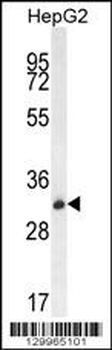 OR4K5 Antibody (C-term)