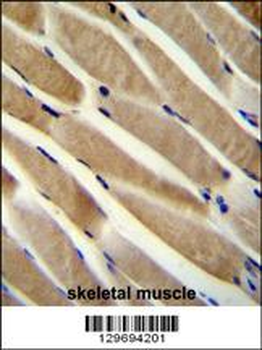 TRIM7 Antibody (N-term)