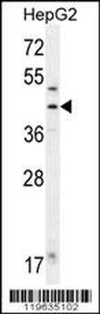 FAH Antibody (N-term)