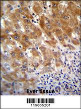FAH Antibody (N-term)