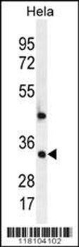MED7 Antibody (Center)