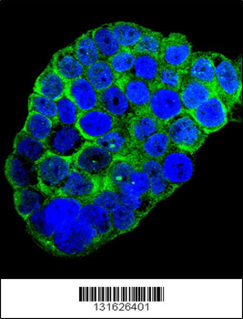 C1QC Antibody (Center)